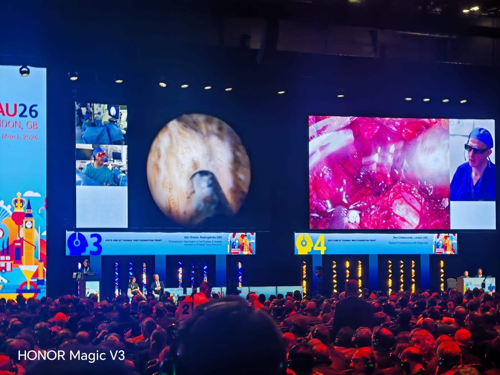 Our Consultant Surgeons Shine at EAU Annual Congress 2026